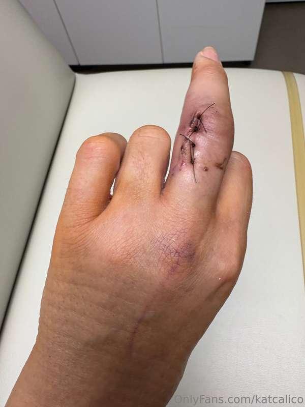 4 stiches and an arrow 