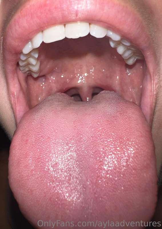 The other day, I asked my dad’s gf to take a pic of my infla..