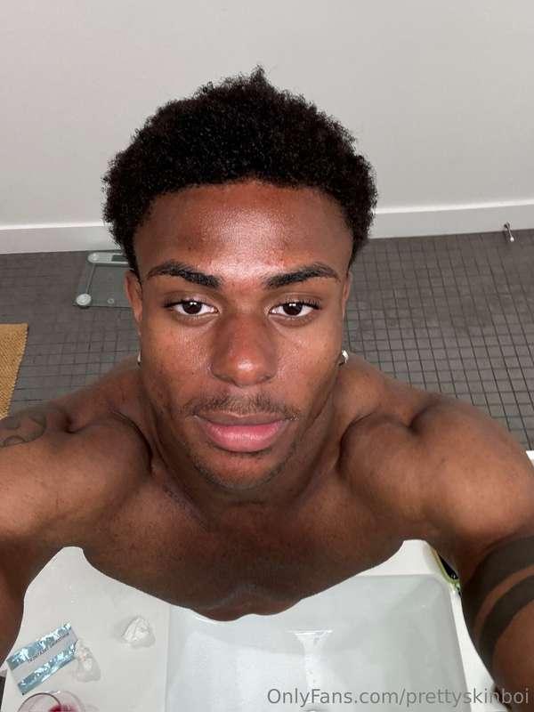 prettyskinboi main image