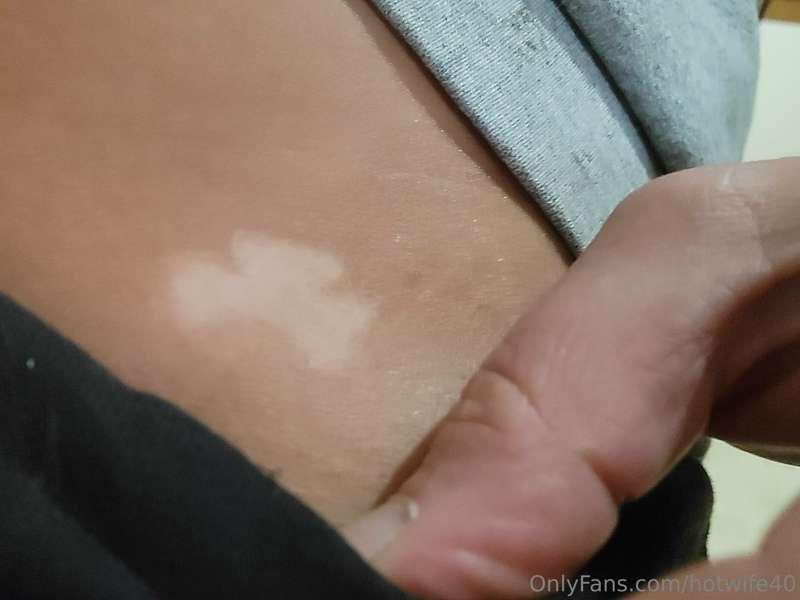 Been going to the tanner now for 4 months here is the clover..