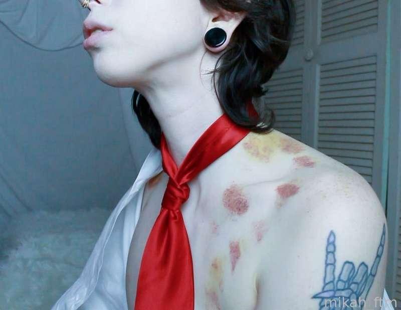 mikah_ftm image #3