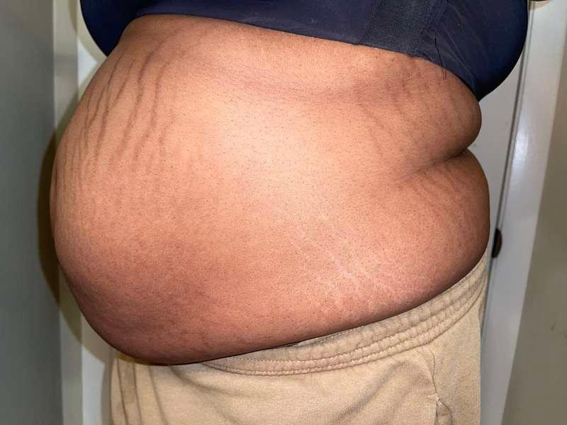 post beer and soda bloat / belly update!