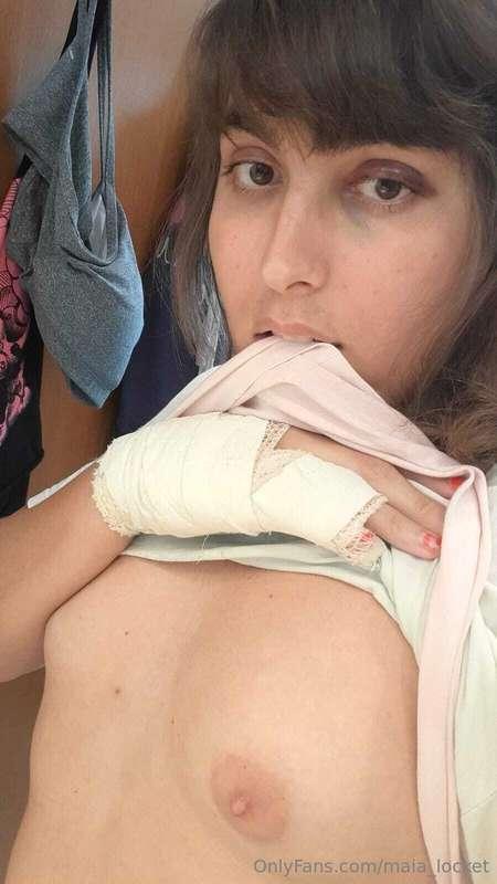 Bruised, but I’m here to please. 🔮 While my purple eye and b..