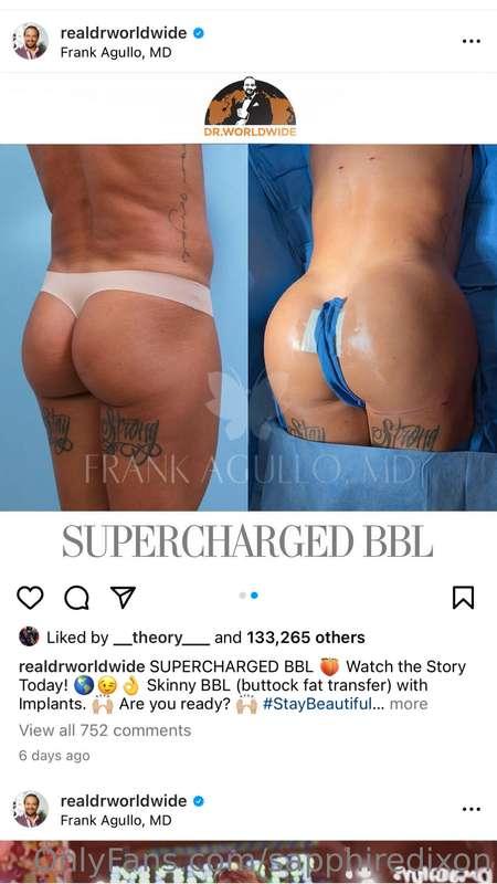 This is a before and after…. But in this photos I still have..
