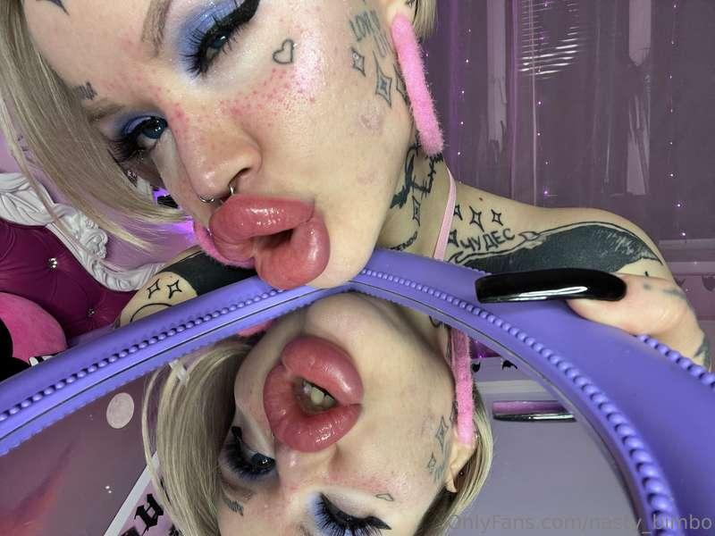 Babes im getting lip fillers in Thursday!! Are you excited a..
