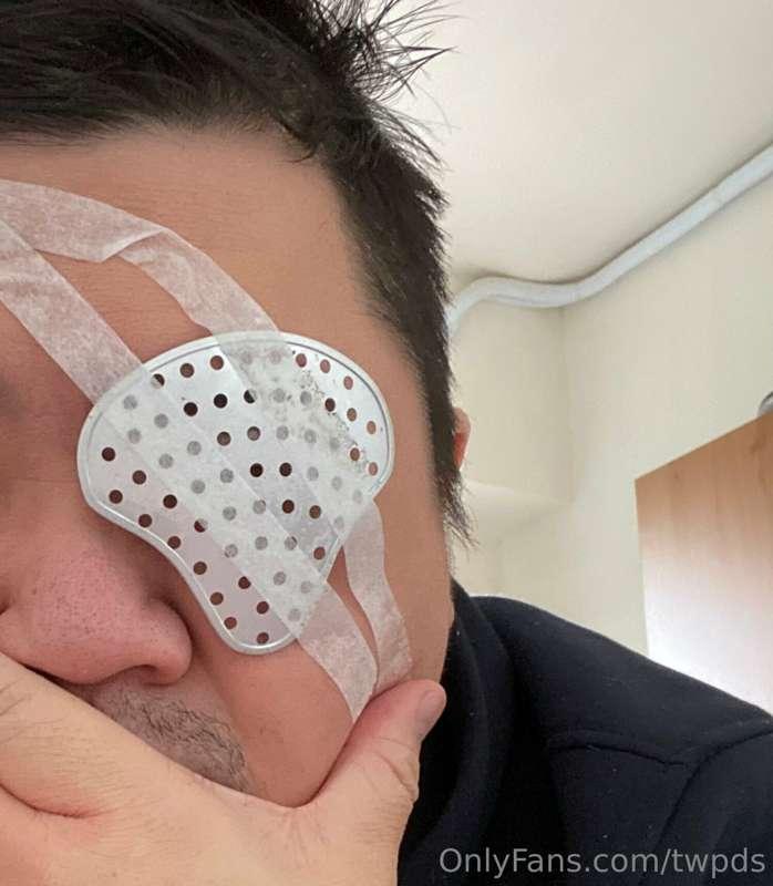 我現在的樣子很狼狽，手術過程3個多小時。如果要復原的更好，就要固定趴著一個月，趴著睡、閱讀或使用手機、電腦。醫生開立了一..