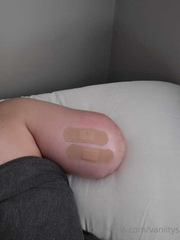 Im home and resting,  they had to keep me over night due pai..