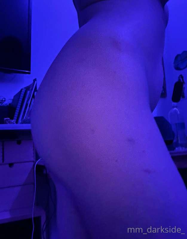 Can you guess what gave me these bruises? 😈😈
