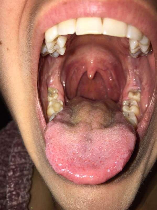 discover the uvula of this beautiful girl!!!!