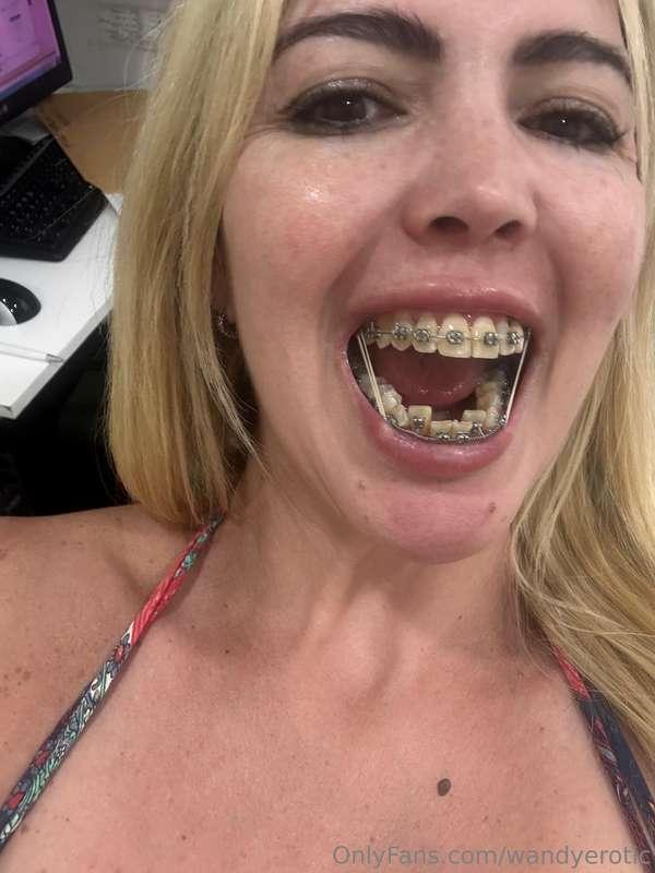 The bands are harder and fit me better 