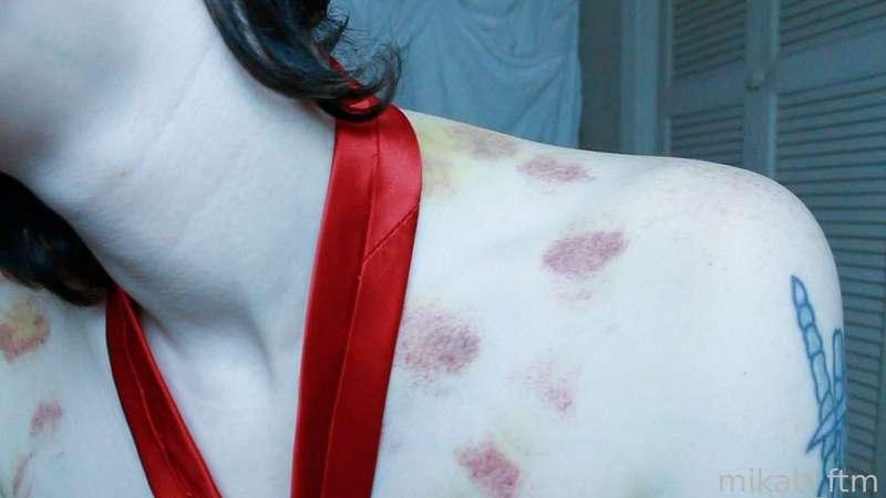 mikah_ftm image #26