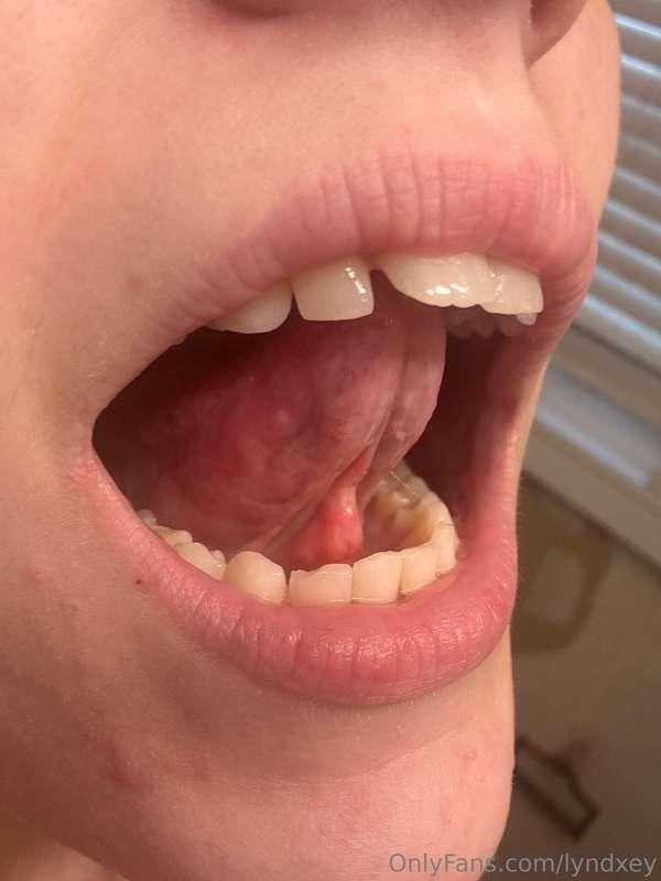 If you look close enough, you can see where I split the tiss..