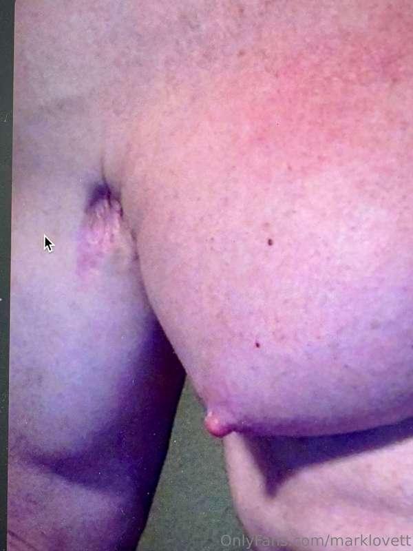 Who wants to play nip and tuck?