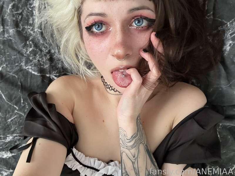 anemiaa image #3