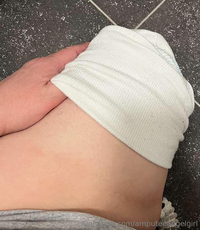 Time for this amputee girl to undress her stump 😉 