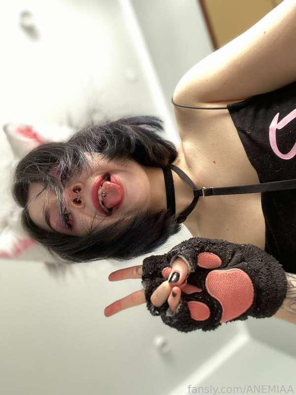 anemiaa image #1
