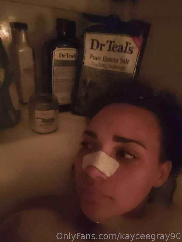 Pore strips for the win.