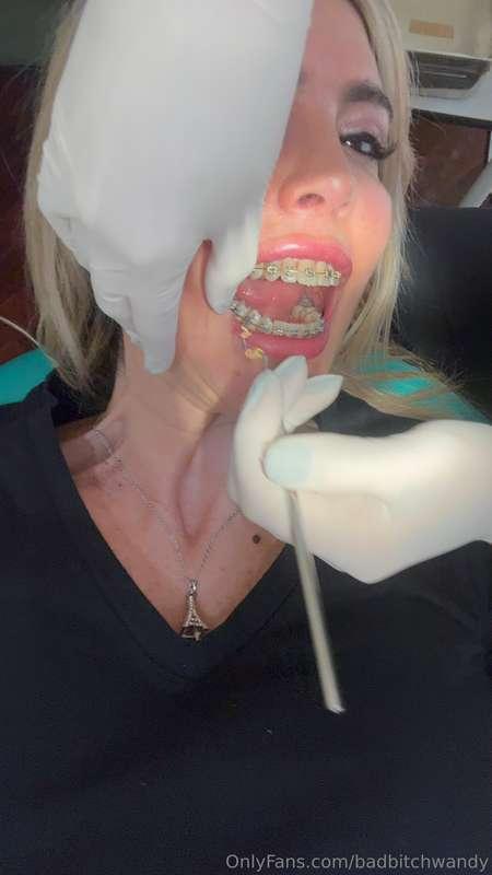 Do you think he can take off all my bands in one go? 🦷