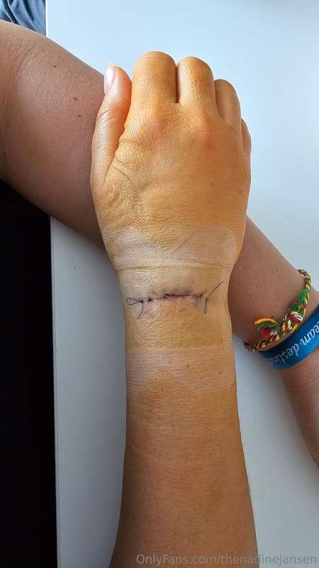 That still looks a bit scary, but it's better than last week..