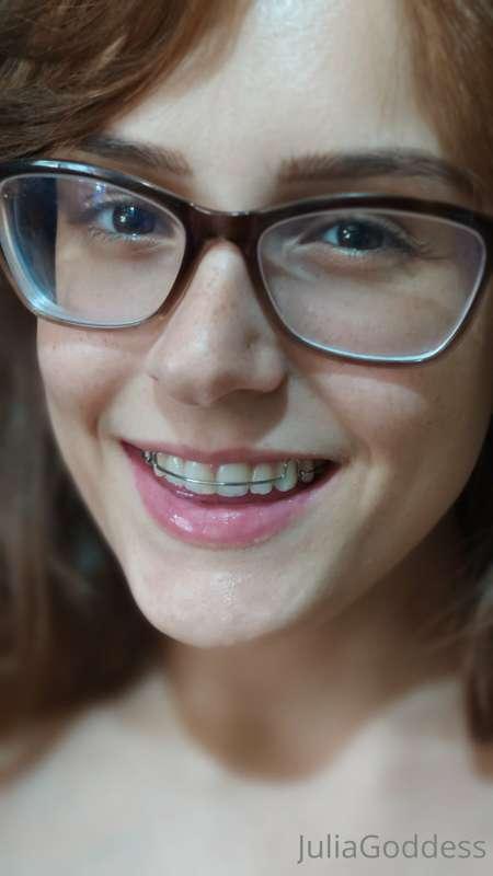 What do you think of my retainer smile? 😃😃
O que você acha d..