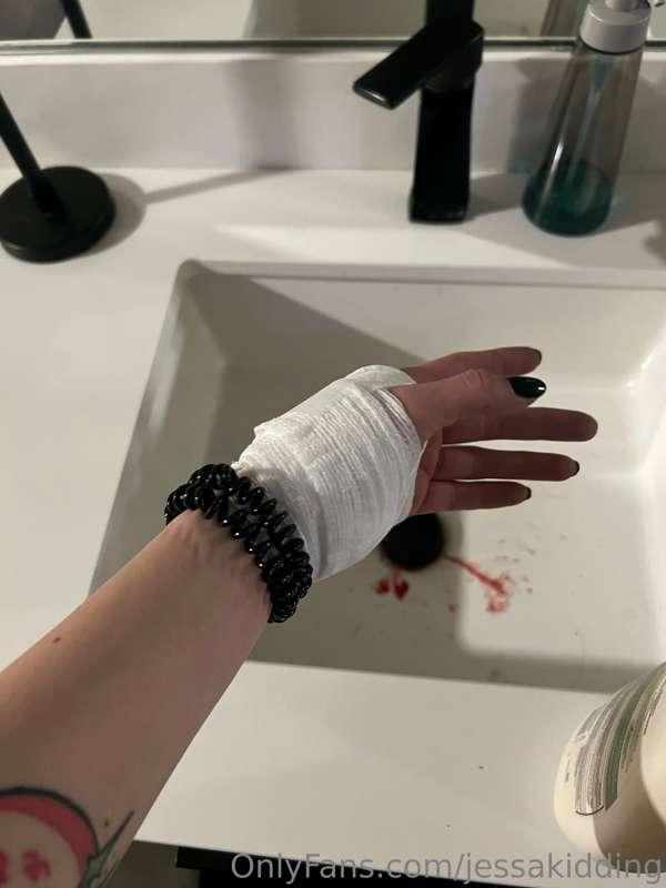 Well, guys, I cut my hand. And can’t lift for a couple weeks..
