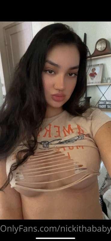 Almost 1 week post op