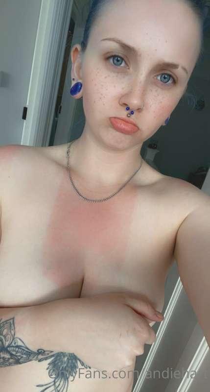 Not feeling too sexy anymore with this stupid ass sunburn 🙃😆