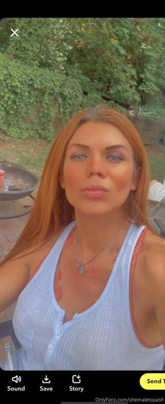 I can’t stop with the Botox 🤫🤫🤫🤳🏽🤳🏽😍😍🥰🥰