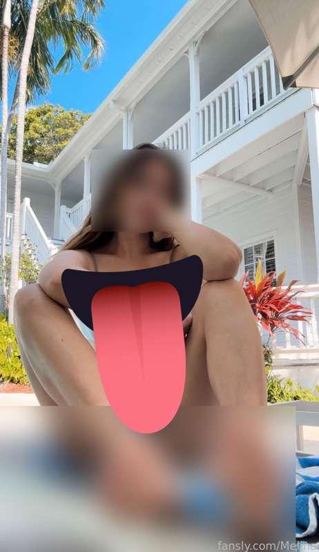 DM