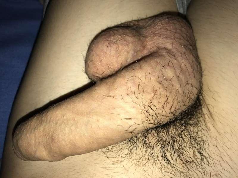 🙈