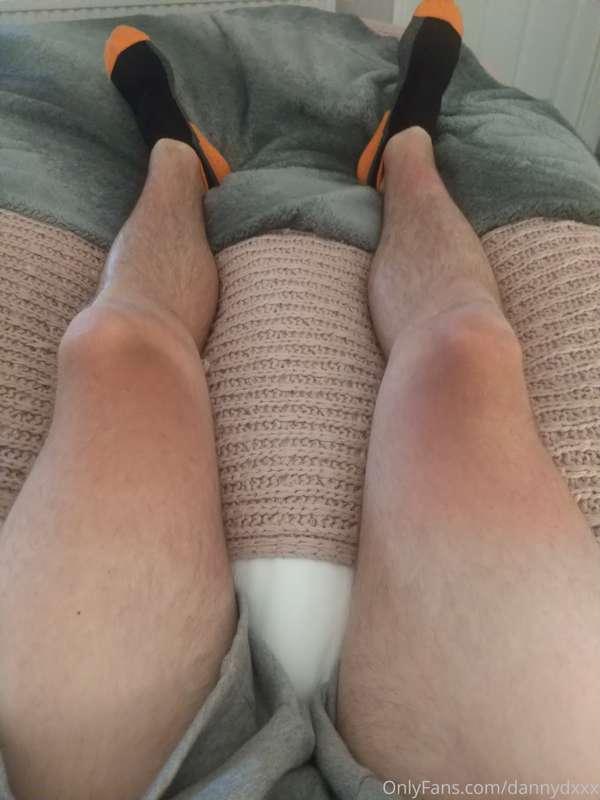 Think I might be slightly burnt 😂 now what could I rub in as..