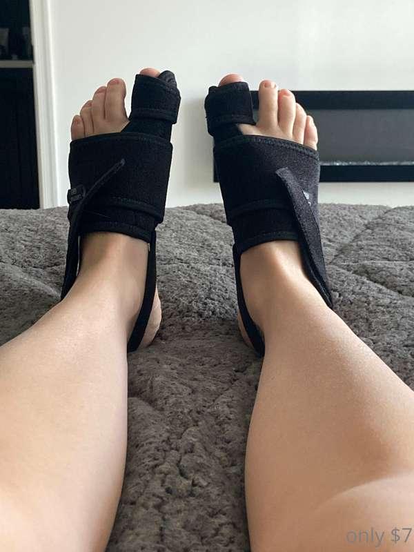 Preventing bunions! Keepin them perfect