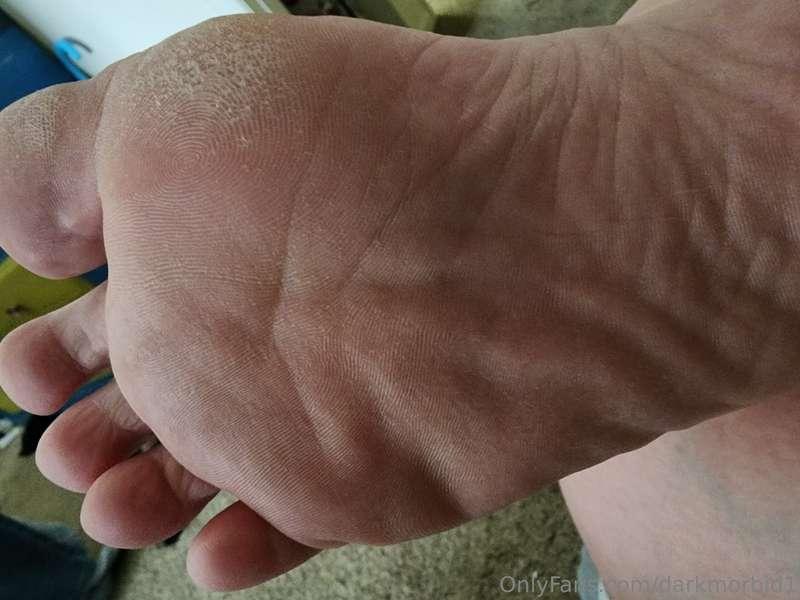 Ooowee looks like these dogs are in need of some lotion. Who..