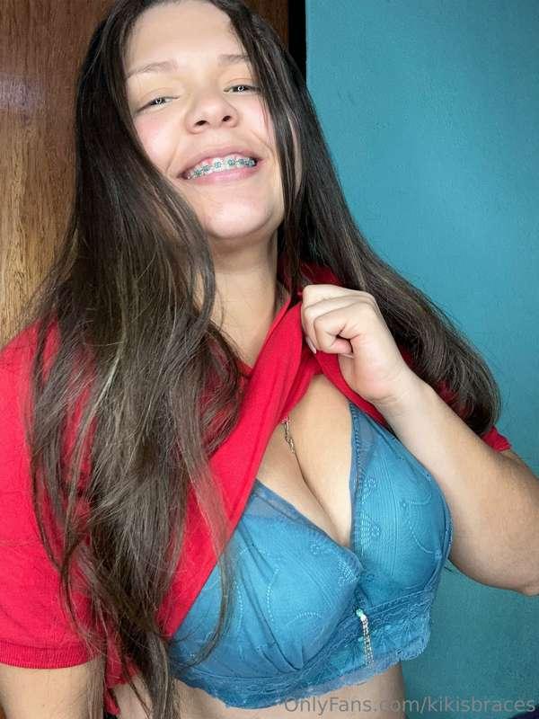 kikisbraces image #6