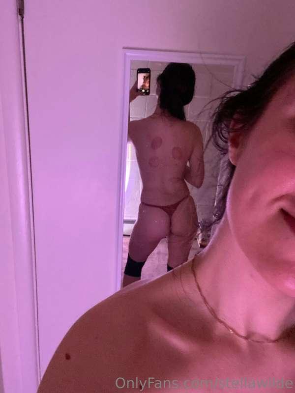 i got my first professional massage yesterday and got cupped..