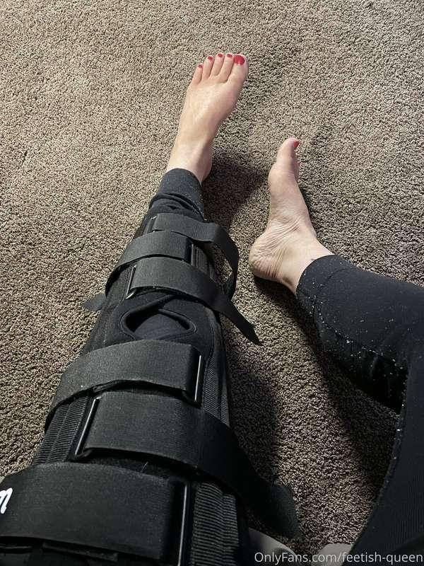 I dislocated my knee and it’s taken me out of action for a l..