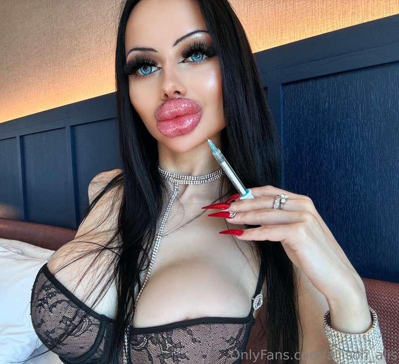 MY BIGGEST LIPS EVER💉 NEW VIDEO🤩 Biting and squeezing my lip..