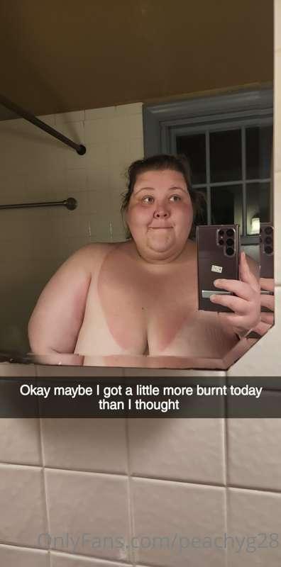 Who wants to rub me down with aloe?