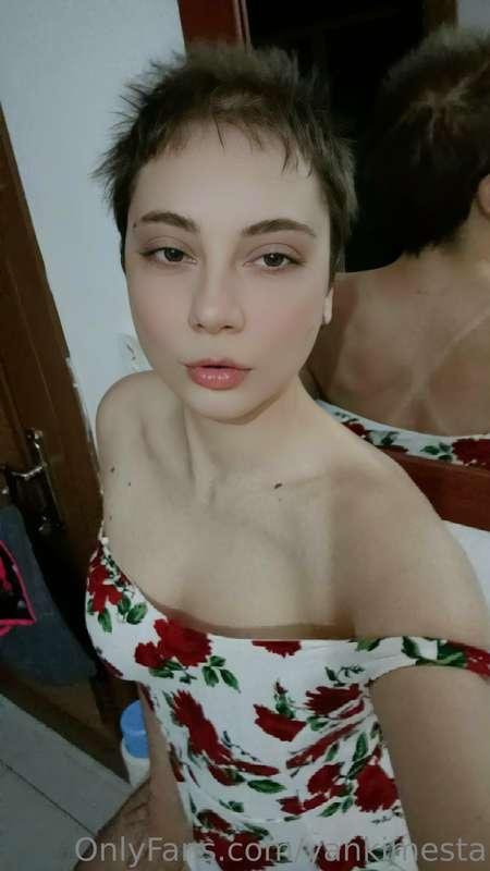 Burnt baby 
.
sırtıma güneş kremi sürmemişim