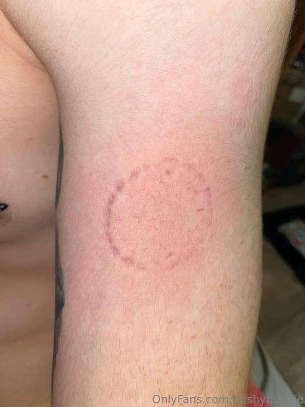 Let me sink my teeth into you!