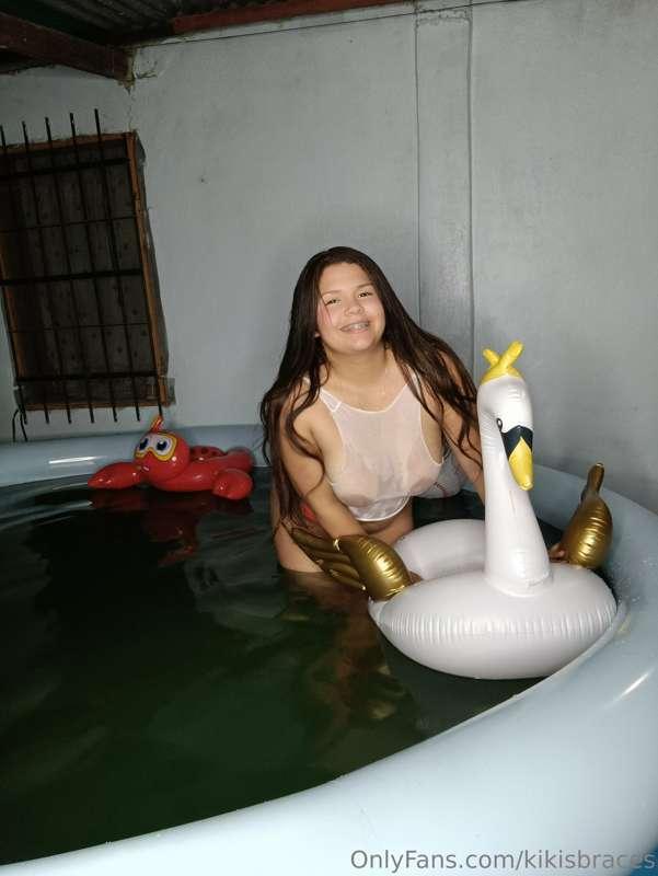 kikisbraces image #1