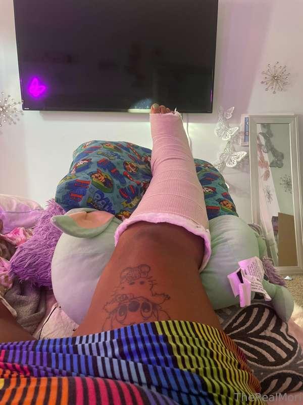 surgery was successful🩵