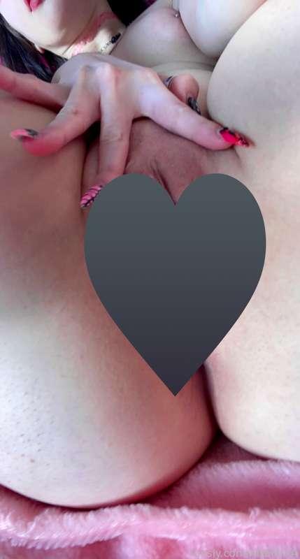 anemiaa image #2