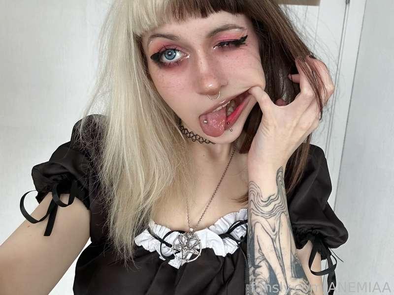 anemiaa image #2