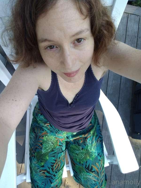 anamolly image #2