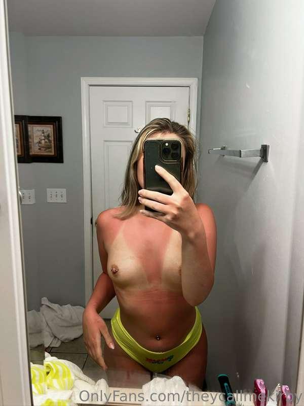 I’m peeling now 🥲