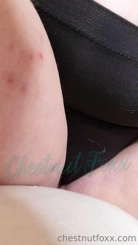 chestnutfoxx image #0
