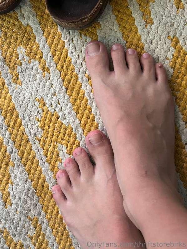 Feet super swollen today. So sad.