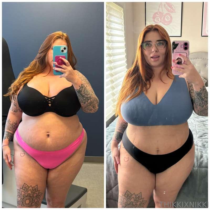 Results are in. 7 days post opp today. 