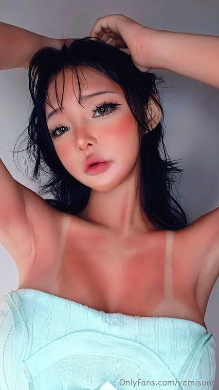 sun burns my skin.🥵